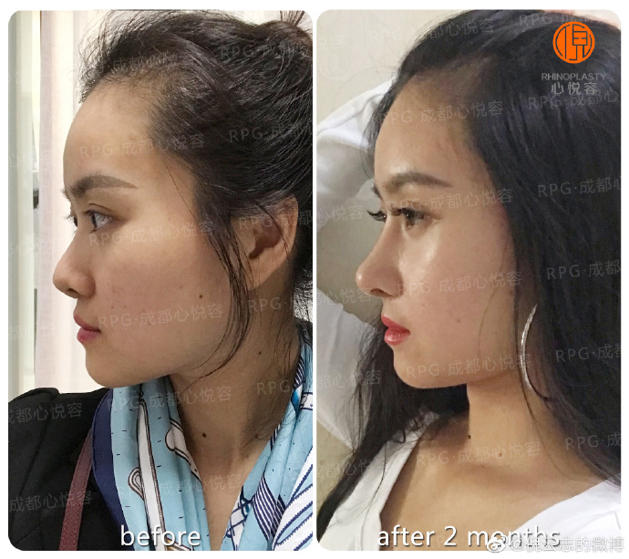 王会勇和倪云志鼻修复哪个好？王会勇和倪云志简介、案例、预约