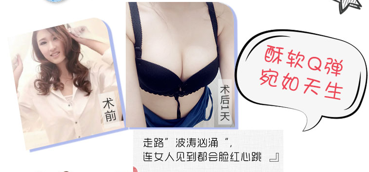 广州做丰胸最好的专家是谁？江华和王世虎哪个好？王世虎和江华案例预约