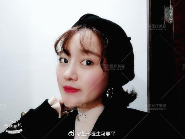 北京做鼻尖垫鼻尖最好的专家推荐：沃尔冯雁平（预约价格效果）怎么样