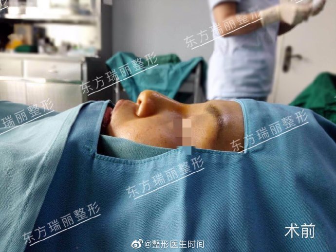 全国做鼻部整形&鼻修复最好的专家：时间医生（效果价格预约）怎么样？
