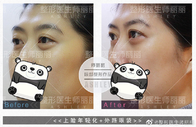 中国眼综合最知名的专家有哪些？师丽丽做眼综合效果好吗？