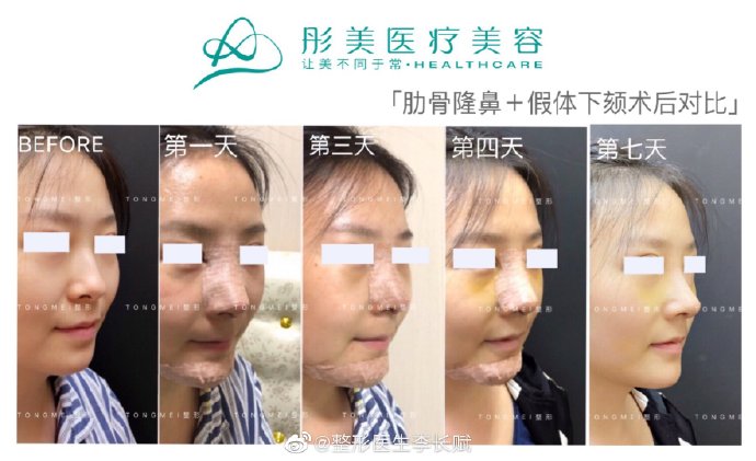 北京鼻综合专家排名李长赋王军李劲良刘彦军师俊莉巫文云王志坚哪个最好？