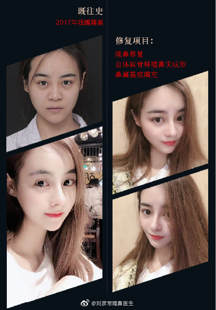 北京鼻综合专家排名李长赋王军李劲良刘彦军师俊莉巫文云王志坚哪个最好？