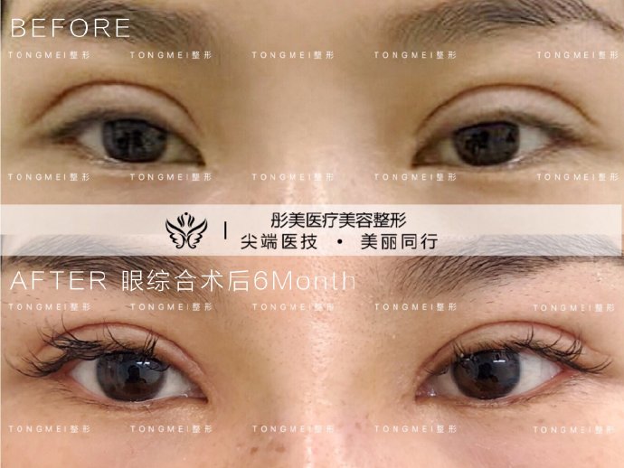 国内知名度较高双眼皮修复专家王世勇刘风卓王振军田国静刘辅容杜园园谁最好？