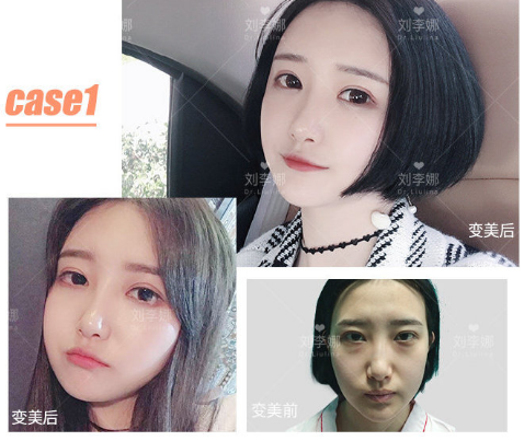 上海脂肪填充整形医院哪个好？上海九院伊莱美百达丽艺星美莱谁最好？