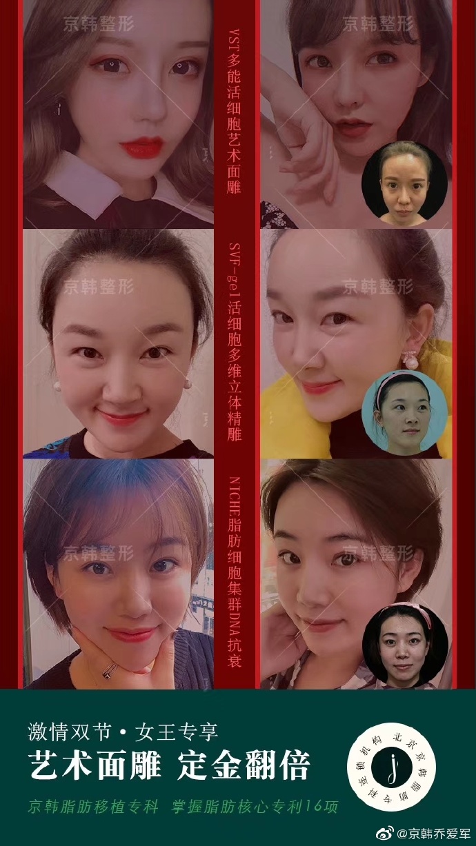 北京脂肪填充名医都有哪些呢？北京做自体脂肪填充最好的专家排名