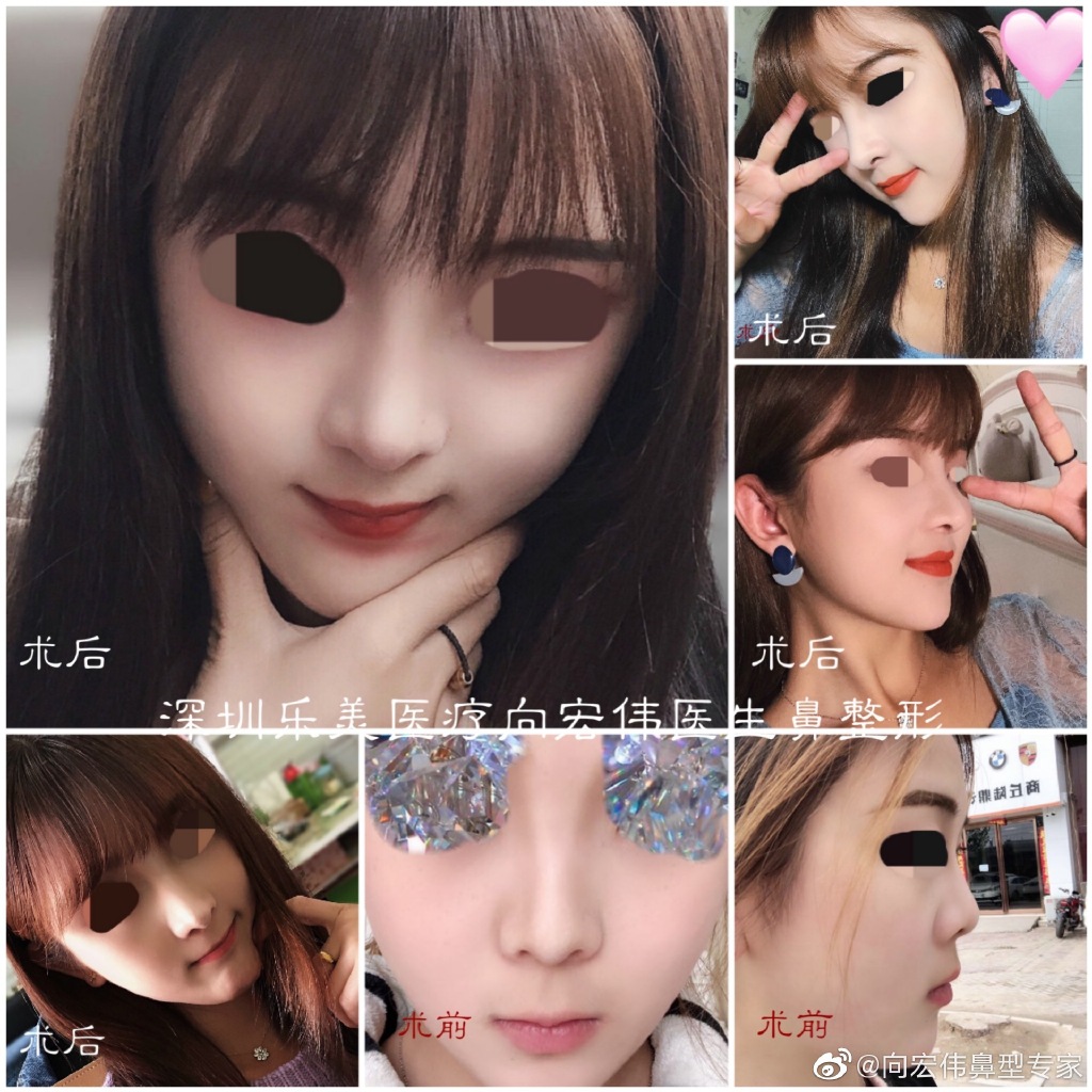 2020年深圳鼻综合的医生排名:向宏伟陈桂飞罗志敏尹卫民牛克辉龙鹏辉