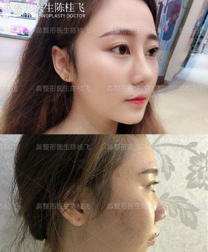 2020年深圳鼻综合的医生排名:向宏伟陈桂飞罗志敏尹卫民牛克辉龙鹏辉