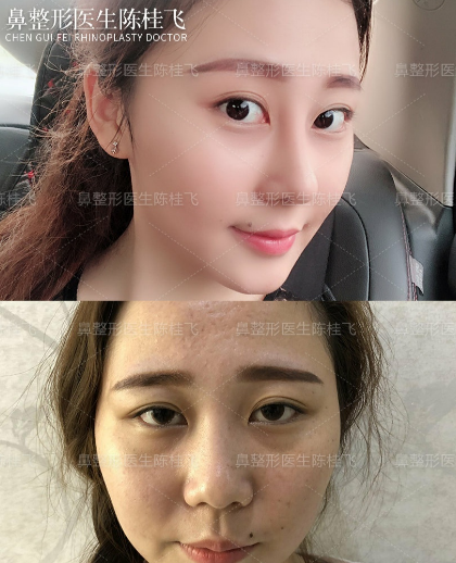 2020年深圳鼻综合的医生排名:向宏伟陈桂飞罗志敏尹卫民牛克辉龙鹏辉