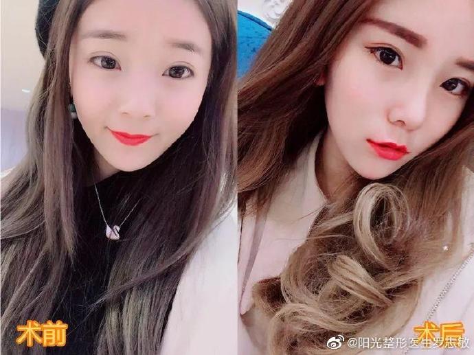 2020年深圳鼻综合的医生排名:向宏伟陈桂飞罗志敏尹卫民牛克辉龙鹏辉