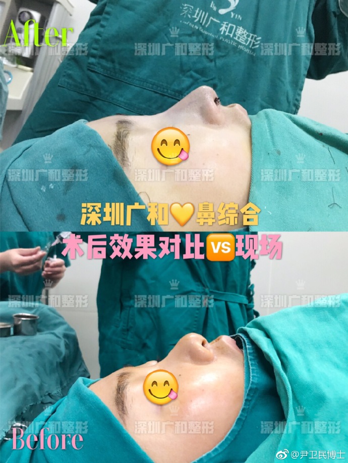 2020年深圳鼻综合的医生排名:向宏伟陈桂飞罗志敏尹卫民牛克辉龙鹏辉