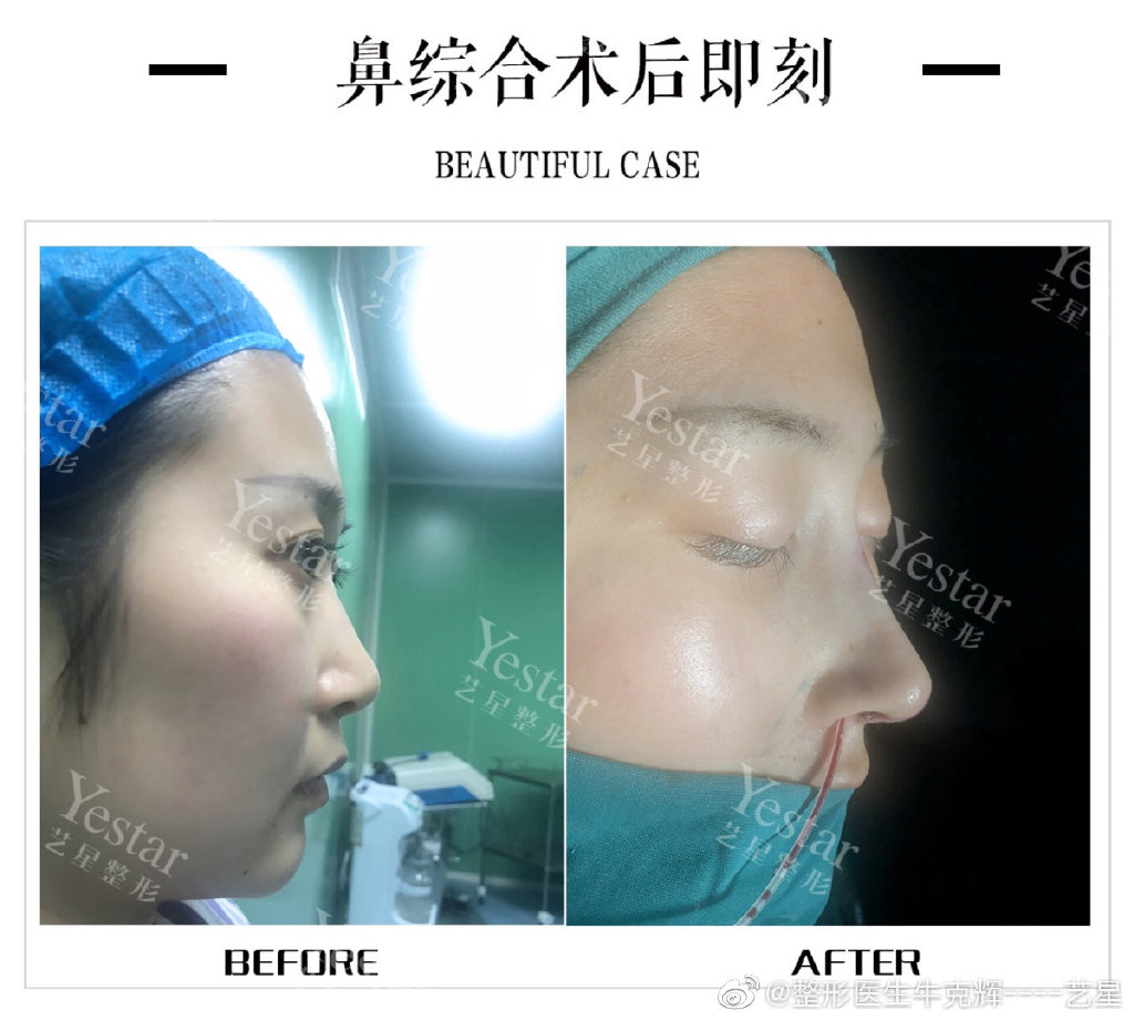 2020年深圳鼻综合的医生排名:向宏伟陈桂飞罗志敏尹卫民牛克辉龙鹏辉