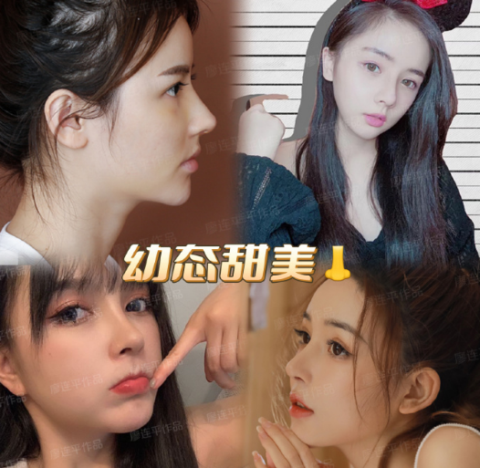 成都鼻修复案例