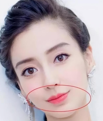 2026国内做人中缩短术好的医生王皓民、赵久丽、谭拯、李泽、周文武、李辉、牟海龙、卢九宁谁最厉害?