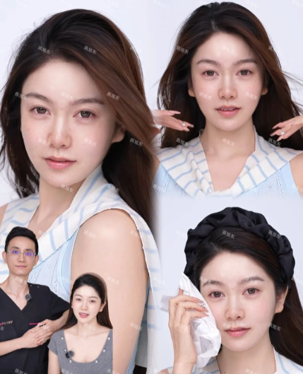 陈旭东微调案例