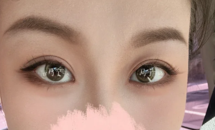 2026年北京八大处双眼皮医生推荐哪个？马宁、梁雪冰、卢建建、李梓菲、宗宪磊、吴荣薇、宋涛？