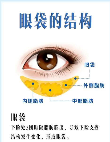 杭州翁胜涛祛眼袋技术怎么样?翁胜涛去眼袋效果好不好?翁胜涛预约电话