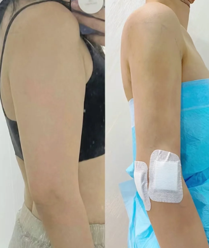 大连吸脂医生哪个好？康乐和郑妍丽做吸脂怎么样？