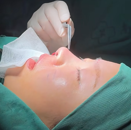 南京隆鼻专家曹海峰和陈天杰哪个鼻修复技术好？