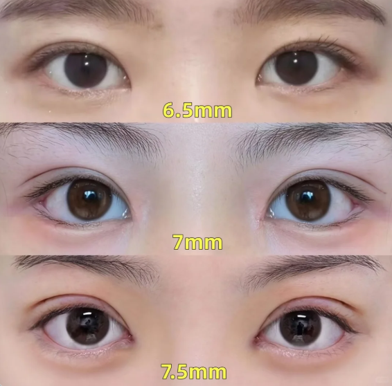 福州双眼皮专家徐丽丽和林振辉哪个做割双眼皮好？