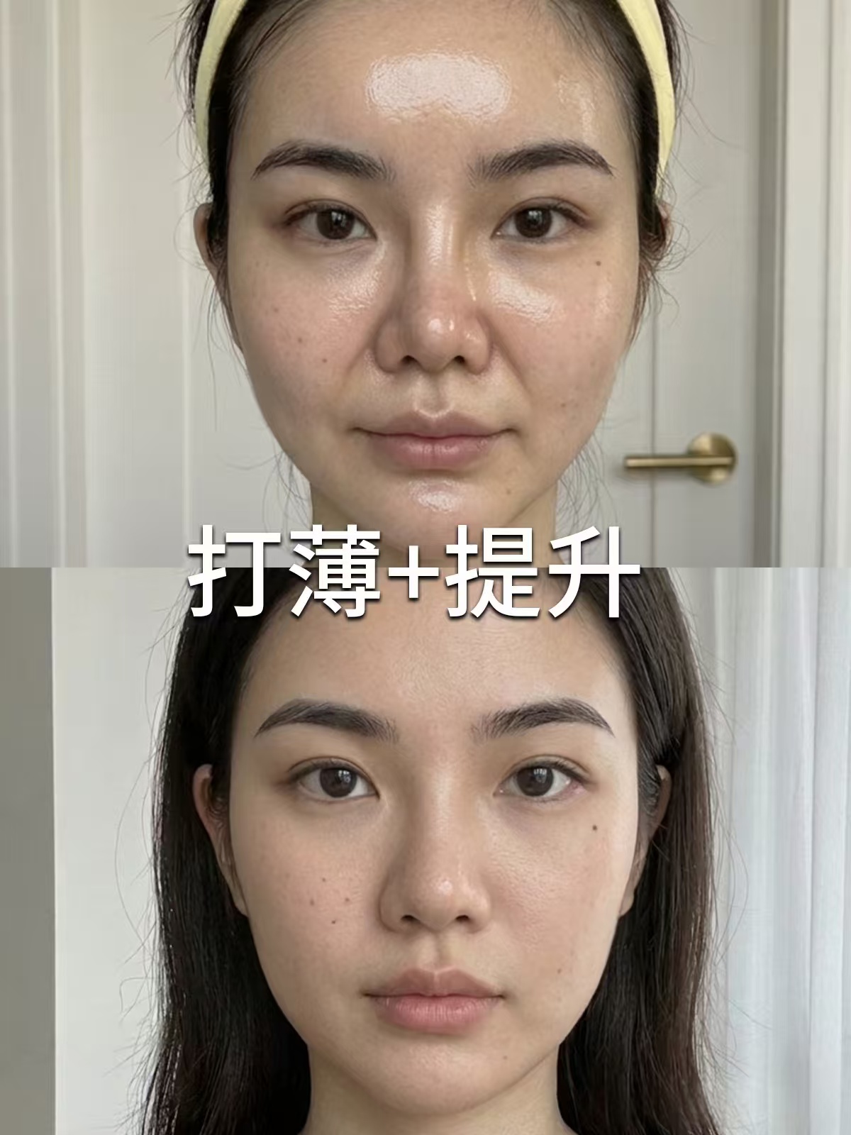 馒化修复