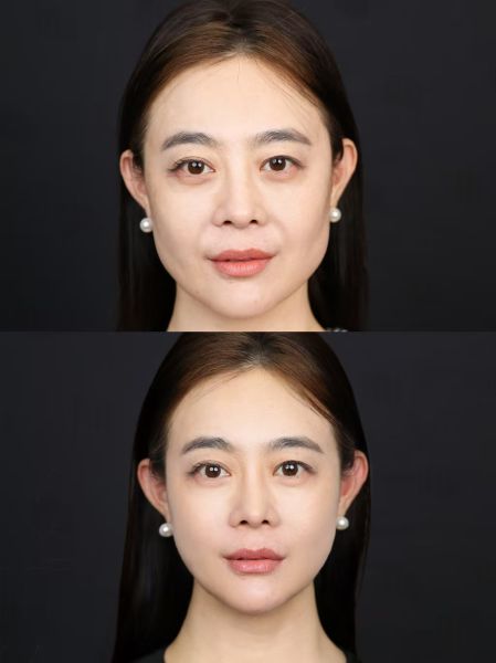北京知名注射抗衰医生:赵岩、李在郁、邢志花、谷亦涵、肖明明、胡金天、杨丽峰、陈翠云谁厉害？