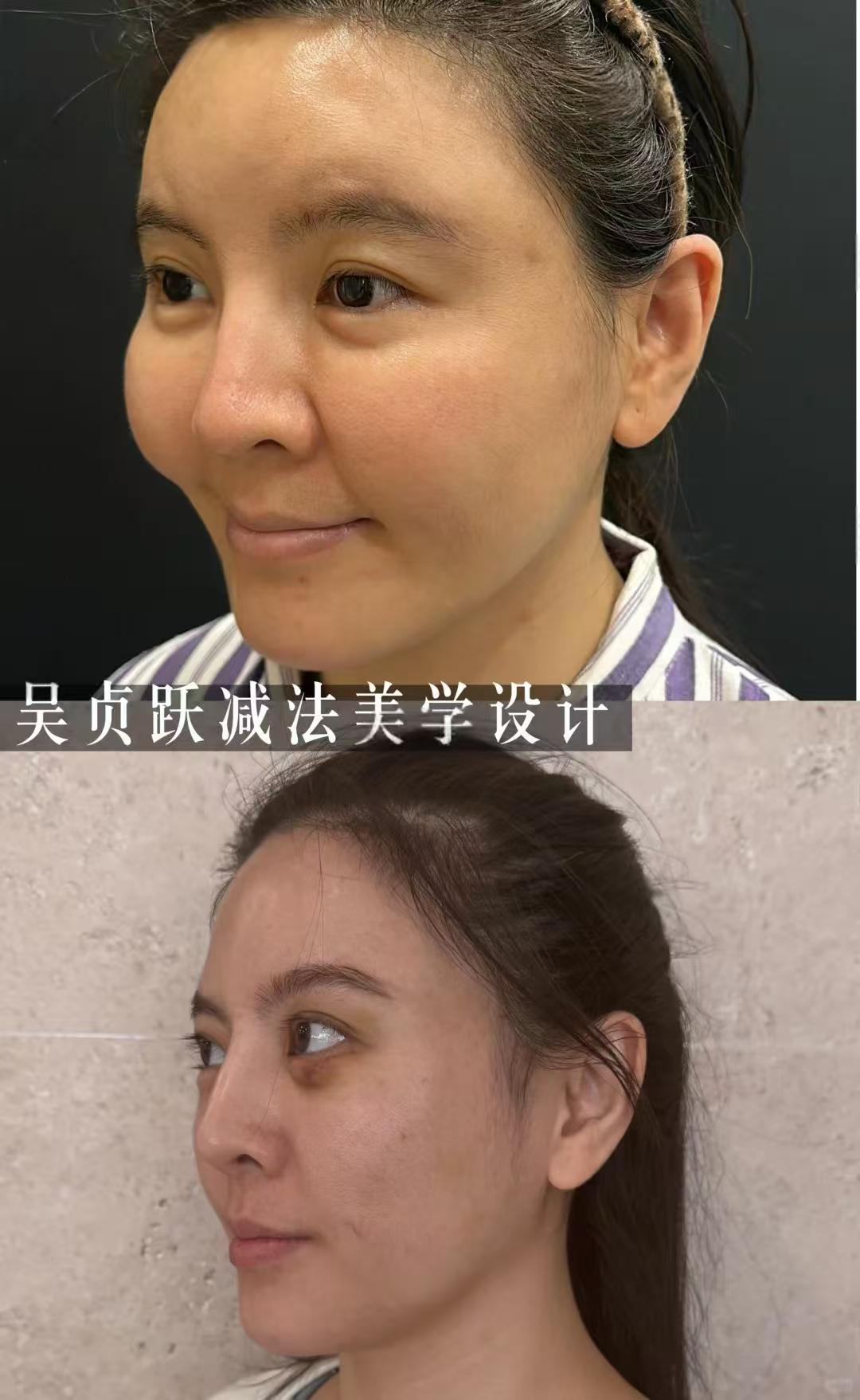 吴贞跃
