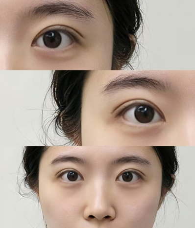 济南割双眼皮医生预约TOP5推荐：韩旭、路秦龙、吴银堂、邹浅、徐永谁技术更好？
