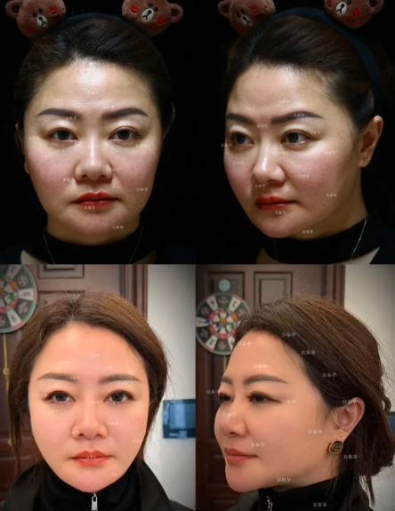 成都馒化修复哪个医院好？馒化修复白振华和李向东哪个医生好？