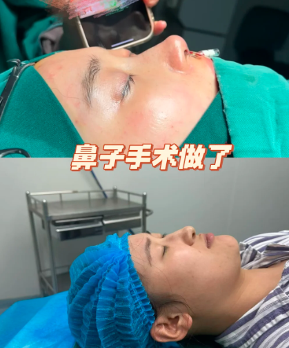 2026济南隆鼻医生哪个好？孟庆杰、李辉、薛峰、马玲、​​杨季涛​​