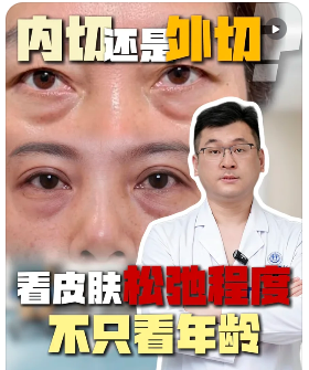 合肥张锦松祛眼袋技术怎么样？张锦松祛眼袋案例口碑预约电话咨询