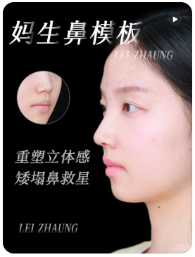 天津隆鼻医生哪个最好？雷状、李卫华、李莹​​哪个做鼻子好？
