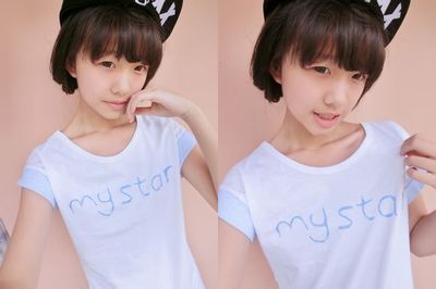 北京八大处整容医院最好的双眼皮修复医生有哪些