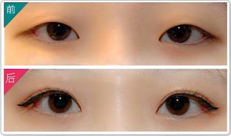 长沙双眼皮修复专家排行榜 长沙双眼皮修复最好的专家排名 长沙双眼皮修复最好的专家有哪些？