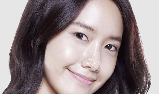 怎样缩小鼻翼？缩小鼻翼多少钱？