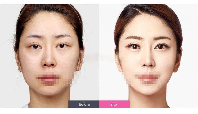 中国最好的双眼皮眼部整形修复专家:王振军(简介、案例、预约) 中国最好的双眼皮眼部整形修复专家:王振军(简介、案例、预约)