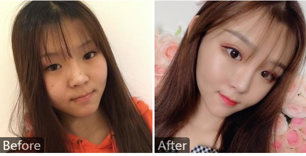 北京八大处整形最好的双眼皮双眼皮修复专家(靳小雷、祁佐良、于晓波等)价格大全 北京八大处整形最好的双眼皮双眼皮修复专家(靳小雷、祁佐良、于晓波等)价格大全