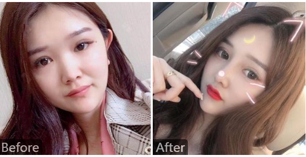 北京八大处整形最好的双眼皮双眼皮修复专家(靳小雷、祁佐良、于晓波等)价格大全 北京八大处整形最好的双眼皮双眼皮修复专家(靳小雷、祁佐良、于晓波等)价格大全