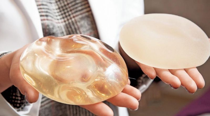 假体隆胸失败案例：隆乳显变石头奶，胸部僵硬缺乏弹性