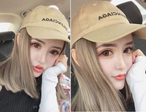 李奇军李方奇王绍国丁小邦奥美定取出谁更厉害？奥美定取出预约