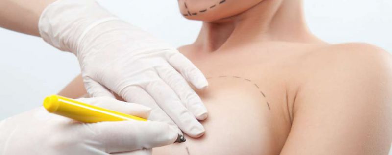 自体脂肪移植_自体脂肪存活率_自体脂肪丰胸推荐_自体脂肪隆乳价格_自体脂肪填补_自体脂肪补脸_自体脂肪丰颊_自体脂肪苹果肌_自体脂肪补额头_自体脂肪隆乳_自体脂肪丰胸推荐