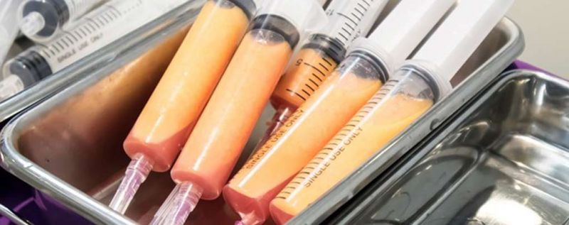 自体脂肪移植_自体脂肪存活率_自体脂肪隆乳价格_自体脂肪填补_自体脂肪补脸_自体脂肪丰颊_自体脂肪苹果肌_自体脂肪补额头_自体脂肪隆乳_自体脂肪丰胸推荐