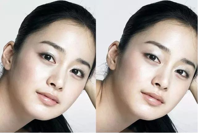 割双眼皮(双眼皮外开)的优点和适应症是什么？割双眼皮(双眼皮外开)注意事项