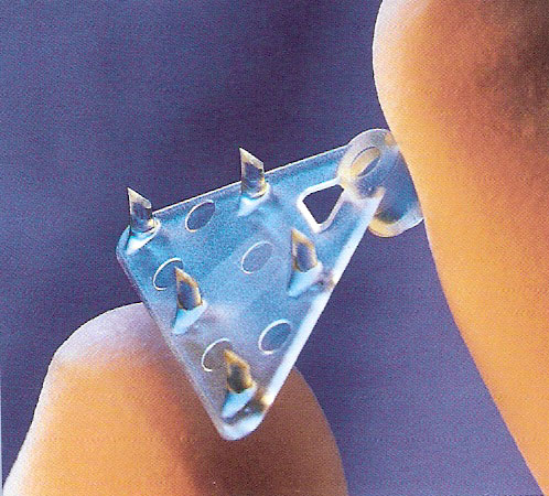 上额拉皮（上面部拉皮）的手术方式和术后保养