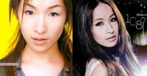 北京公立三甲医院做双眼皮&双眼皮修复最好的专家排名推荐有哪些？