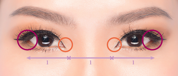 什么是立体双眼放大术？开眼头/眼尾/下眼睑下移