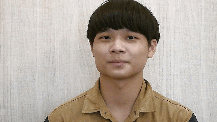 男士隆鼻、鼻中膈延长、垫下巴案例前后对比照片