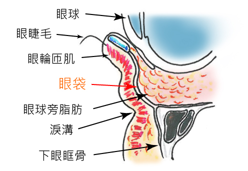 眼袋形成的原因到底是什么？全方位认识眼袋