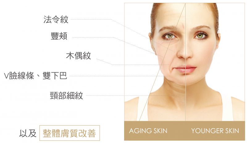 Profound魔方电波除皱系统是什么？Profound魔方电波除皱原理