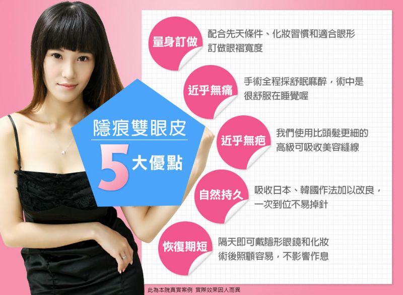 隐痕无痕双眼皮有哪些优点？隐痕双眼皮手术介绍